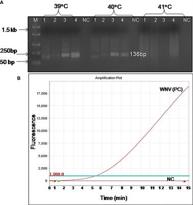 Development and Evaluation of Real-Time Reverse Transcription Recombinase Polymerase Amplification Assay for Rapid and Sensitive Detection of West Nile Virus in Human Clinical Samples